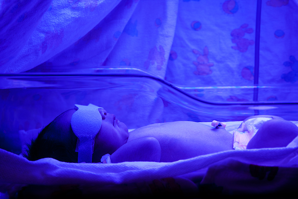 Phototherapy for neonatal hyperbillirubinemia